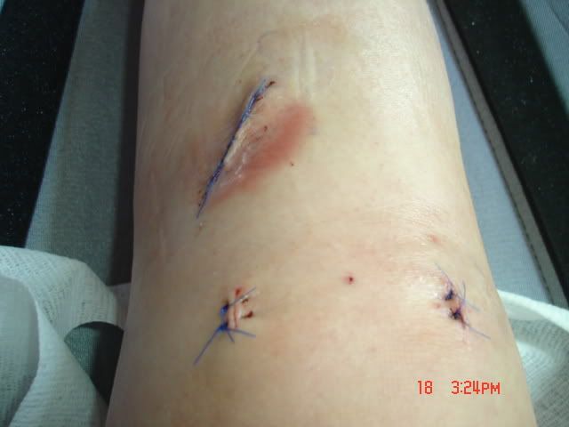 Megans_Knee014.jpg