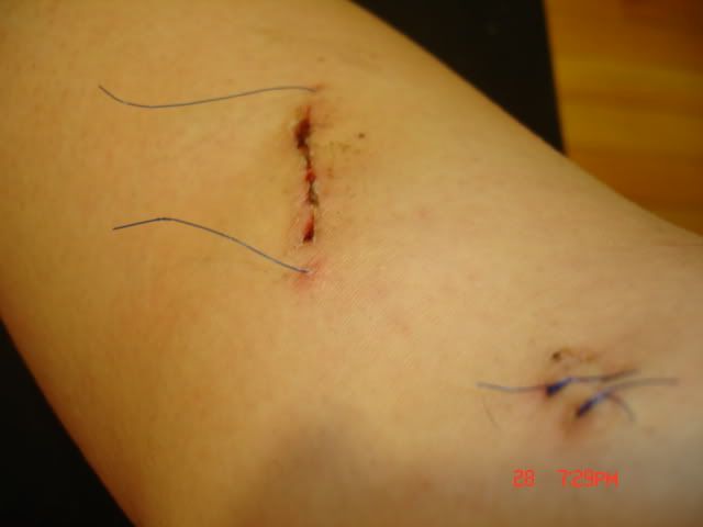 Megans_Knee022.jpg