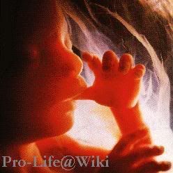 <img:http://i11.photobucket.com/albums/a186/I_Am_The_RaineDrop/Elfpack%20stuff/prolife.jpg>