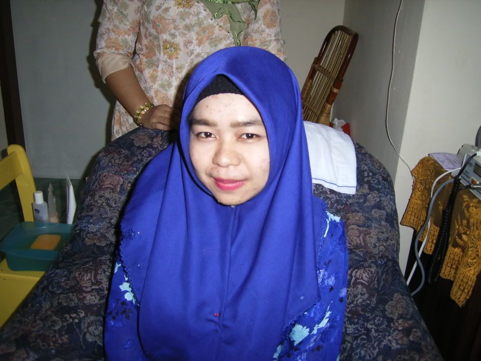1 - before