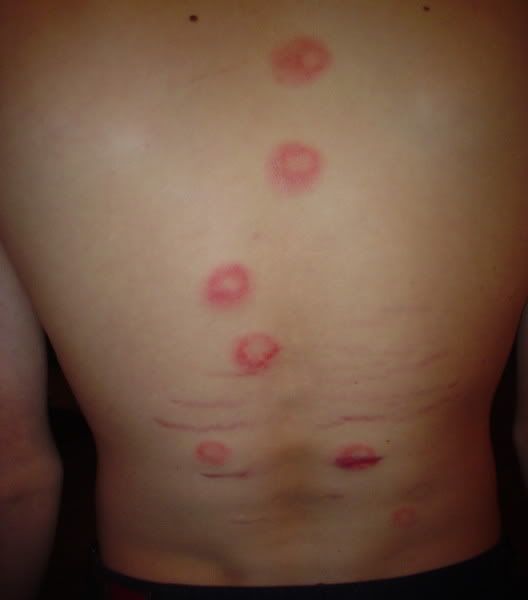 Welts Paintball Forum Paintball guns and gear forums