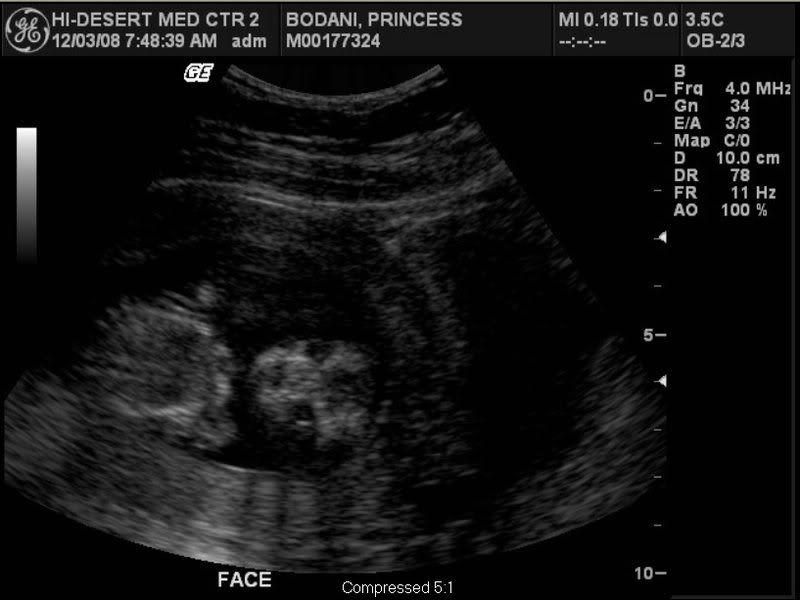 ultrasounds at 13 weeks. pic from 13 weeks 5 days