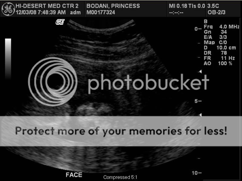 Alien Baby Ultrasound Photo *Voting Closed* - BabyGaga